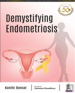 Bertrand.pt - Demystifying Endometriosis
