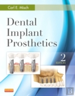 Bertrand.pt - Dental Implant Prosthetics