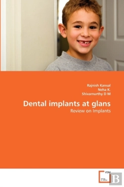 Bertrand.pt - Dental Implants At Glans