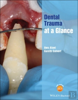 Bertrand.pt - Dental Trauma At A Glance