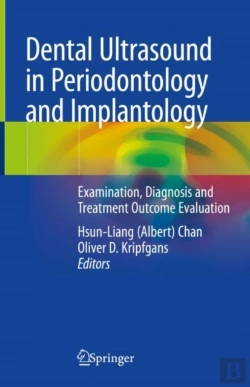 Bertrand.pt - Dental Ultrasound In Periodontology And Implantology