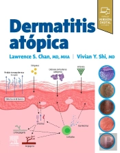 Dermatitis Atopica