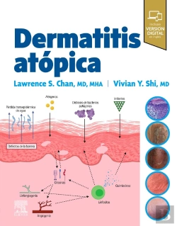 Bertrand.pt - Dermatitis Atopica