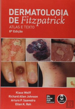 Bertrand.pt - Dermatologia de Fitzpatrick