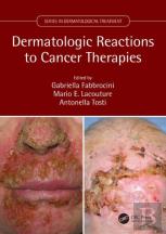 Dermatologic Reactions To Cancer Therapies