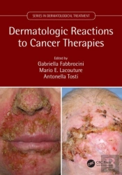 Dermatologic Reactions To Cancer Therapies