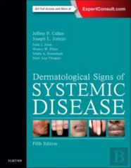Dermatological Signs Of Systemic Disease