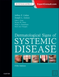Bertrand.pt - Dermatological Signs Of Systemic Disease