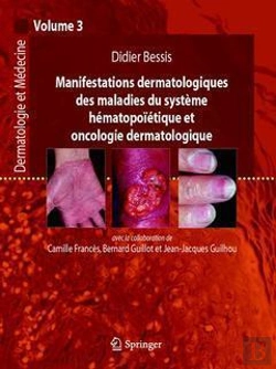 Bertrand.pt - Dermatologie Et Médecine Tome 3 ; Manifestations Dermatologiques Des Maladies Du Système Hématopoiétique Et Oncologie, Dermatologique