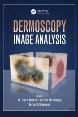 Bertrand.pt - Dermoscopy Image Analysis
