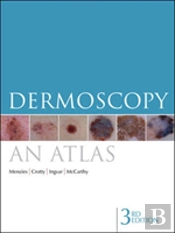 Dermoscopy