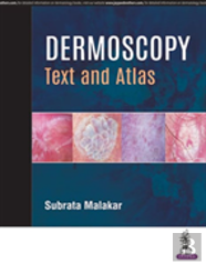 Dermoscopy