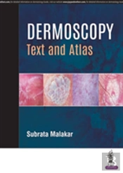 Dermoscopy