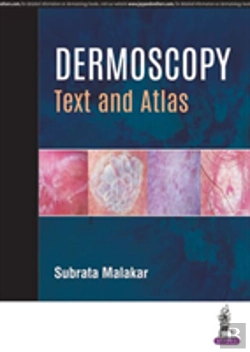 Bertrand.pt - Dermoscopy