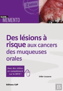 Bertrand.pt - Des Lésions À Risque Aux Cancers Des Muqueuses Orales