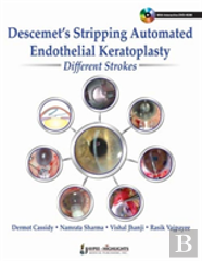 Descemet'S Stripping Automated Endothelial Keratoplasty: Different Strokes