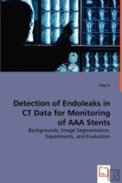 Bertrand.pt - Detection Of Endoleaks In Ct Data For Monitoring Of Aaa Stents