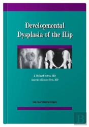 Developmental Dysplasia Of The Hip
