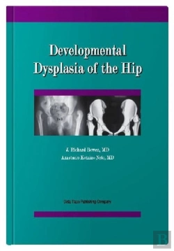 Bertrand.pt - Developmental Dysplasia Of The Hip
