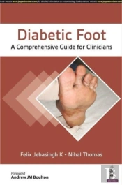 Diabetic Foot