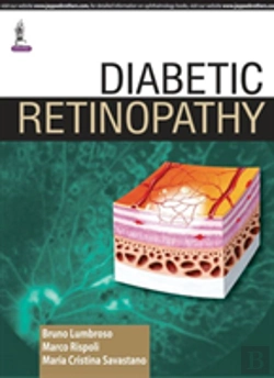 Bertrand.pt - Diabetic Retinopathy