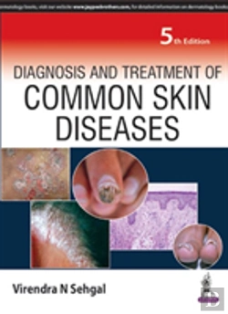 Bertrand.pt - Diagnosis And Treatment Of Common Skin Diseases