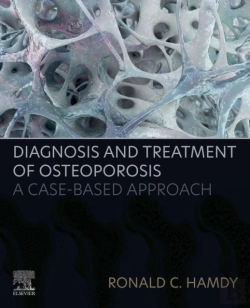Bertrand.pt - Diagnosis And Treatment Of Osteoporosis
