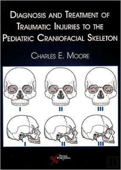 Bertrand.pt - Diagnosis And Treatment Of Traumatic Injuries To The Pediatric Craniofacial Skeleton