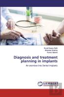 Diagnosis And Treatment Planning In Implants