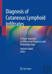 Diagnosis Of Cutaneous Lymphoid Infiltrates