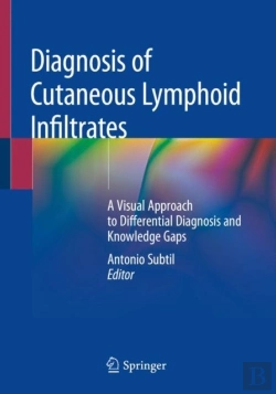 Bertrand.pt - Diagnosis Of Cutaneous Lymphoid Infiltrates
