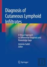 Diagnosis Of Cutaneous Lymphoid Infiltrates