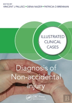 Bertrand.pt - Diagnosis Of Non-Accidental Injury