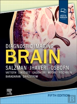 Bertrand.pt - Diagnostic Imaging: Brain