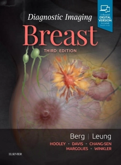 Bertrand.pt - Diagnostic Imaging: Breast