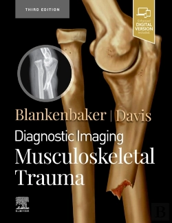Bertrand.pt - Diagnostic Imaging: Musculoskeletal Trauma