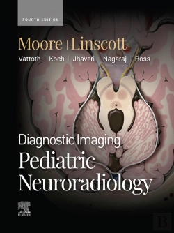Bertrand.pt - Diagnostic Imaging: Pediatric Neuroradiology - E-Book