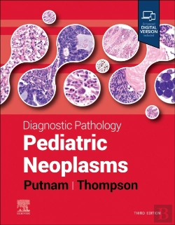 Bertrand.pt - Diagnostic Pathology: Pediatric Neoplasms