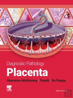 Bertrand.pt - Diagnostic Pathology: Placenta - E-Book