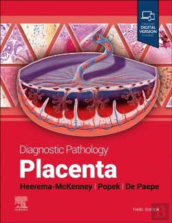Bertrand.pt - Diagnostic Pathology: Placenta