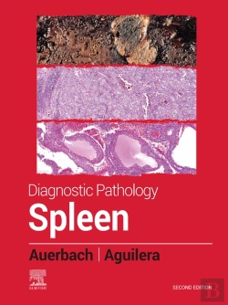 Bertrand.pt - Diagnostic Pathology: Spleen - E-Book