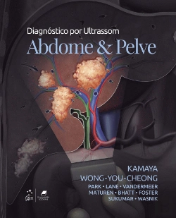 Bertrand.pt - Diagnóstico por Ultrassom - Abdome e Pelve