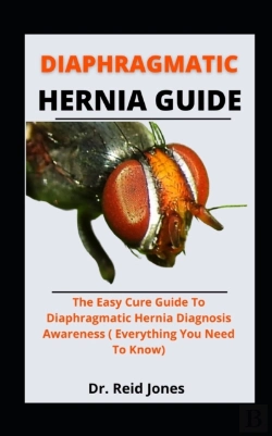 Bertrand.pt - Diaphragmatic Hernia Guide
