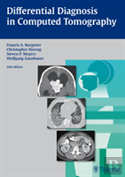 Differential Diagnosis In Computed Tomography