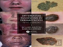 Differential Diagnosis In Dermatology