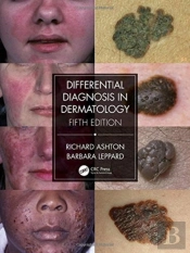 Differential Diagnosis In Dermatology