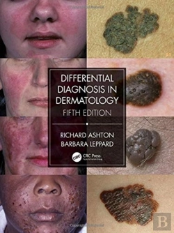 Bertrand.pt - Differential Diagnosis In Dermatology
