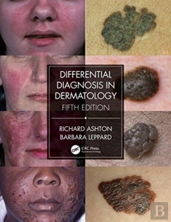 Bertrand.pt - Differential Diagnosis In Dermatology