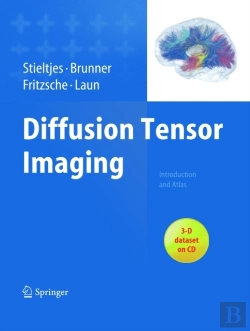 Bertrand.pt - Diffusion Tensor Imaging