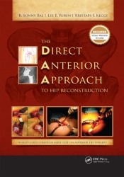 Direct Anterior Approach To Hip Reconstruction